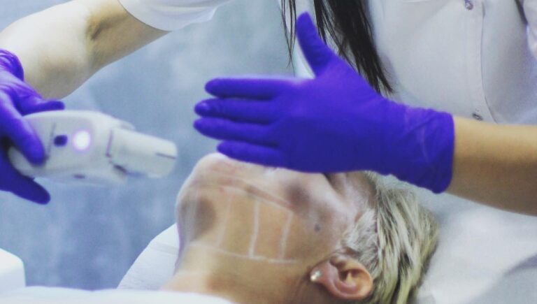 Skuteczny lifting bez&nbsp;skalpela – zabieg HIFU